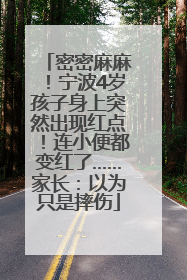 密密麻麻！宁波4岁孩子身上突然出现红点！连小便都变红了……家长：以为只是摔伤